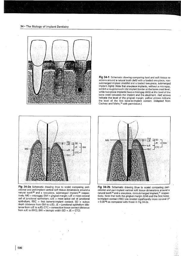 Biology of implant dentistry